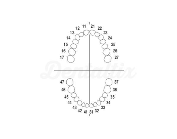 ANA-4: vervangtanden voor typodont ANA-4 V