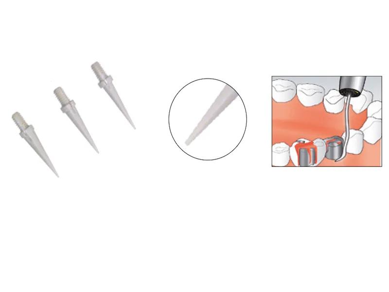 POLYMEERPENNEN VOOR SONICFLEX TIP (30)