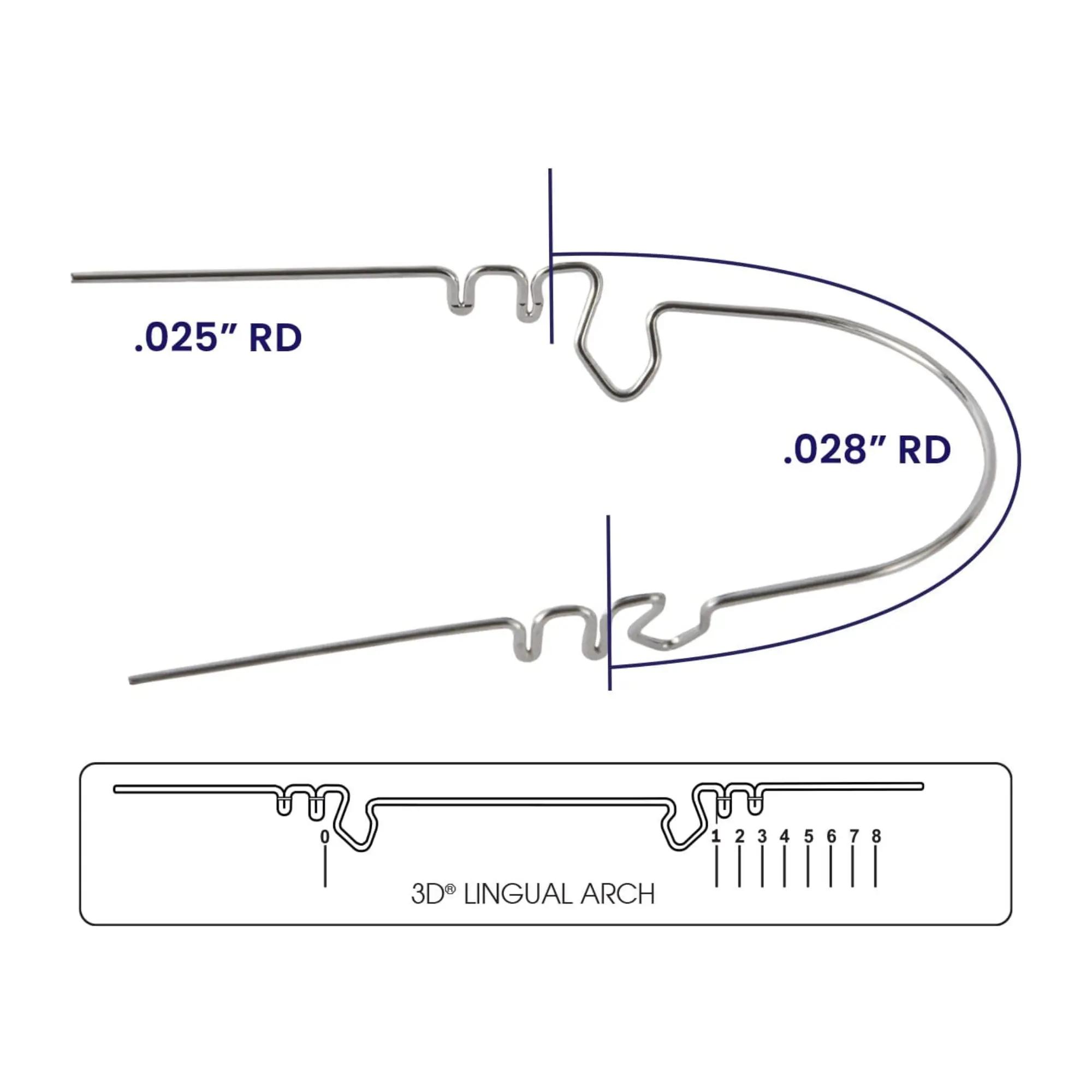 Arc lingual 3D - système Wilson (3)