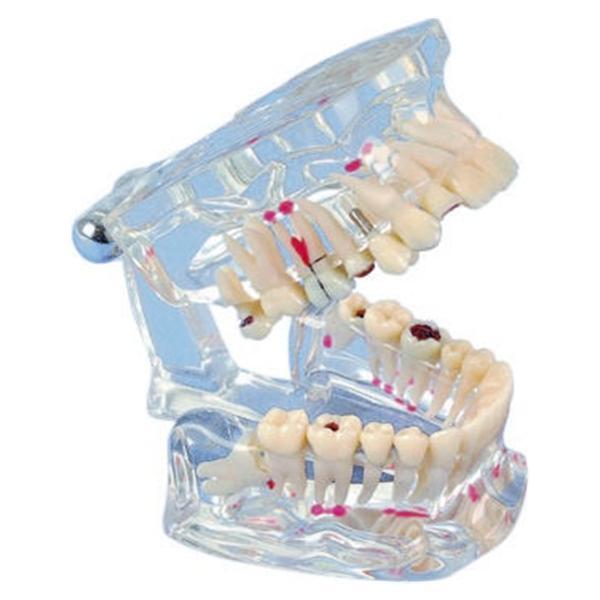 Démo modèle de denture - 80508