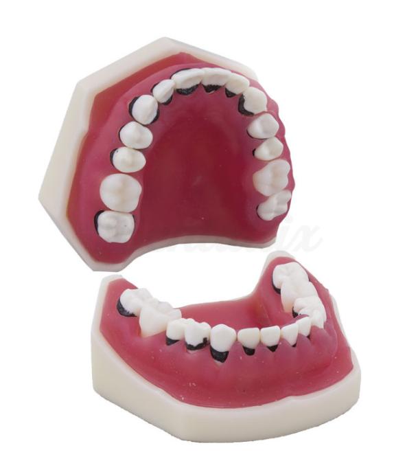 Parodontie-typodont zonder articulator