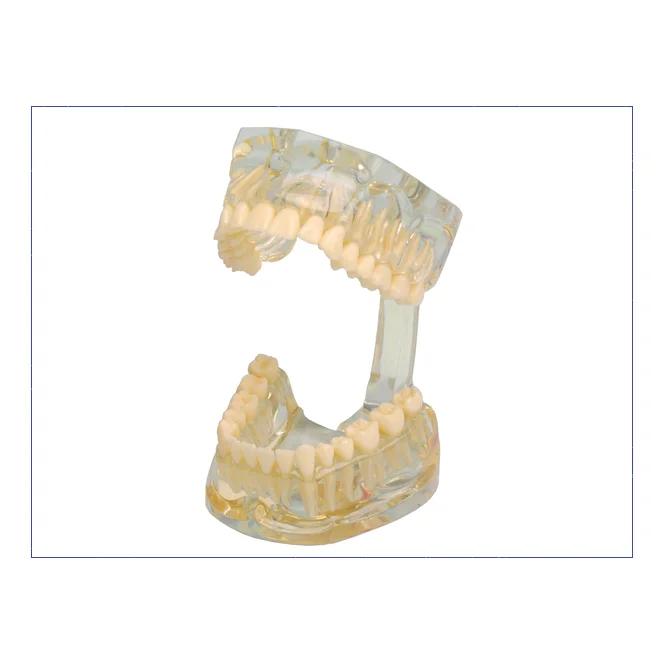 Modele D Etude Dents Transparent