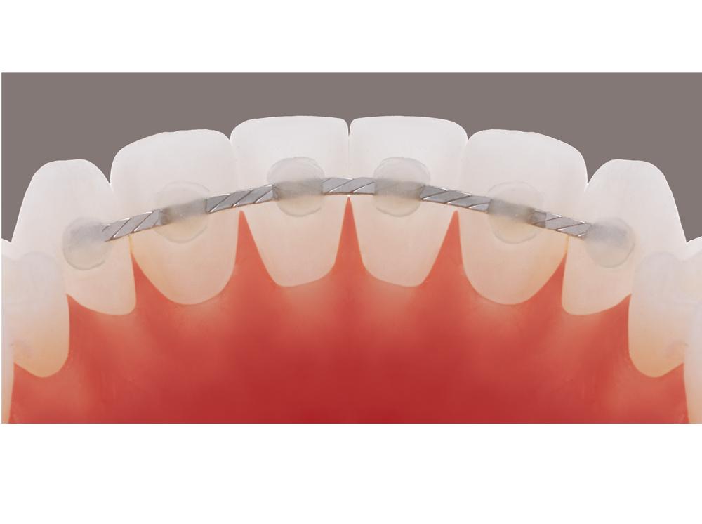 Retainer wire  Titanium Tri-Flex™