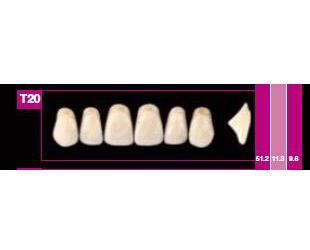 Cosmo HXL dents antérieures supérieures