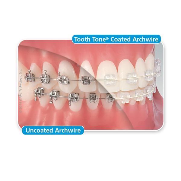 Fil Tooth Tone Coated en acier inoxydable full form, rectangulaire