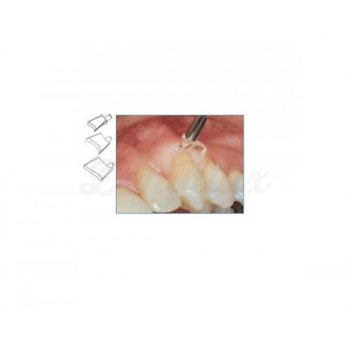 Écarteurs gingivales