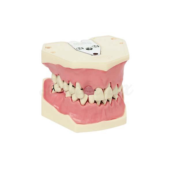 Model Parodontologie A-Pb