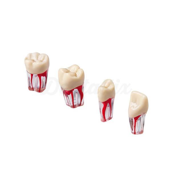 Dents Endo pour la pratique