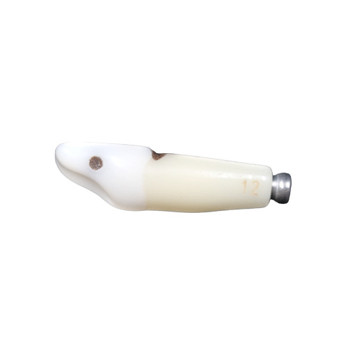 DENTS CARIEES POUR MODELE FRASACO ANKA-4