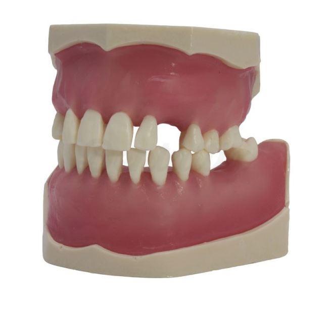 Chirurgiemodel