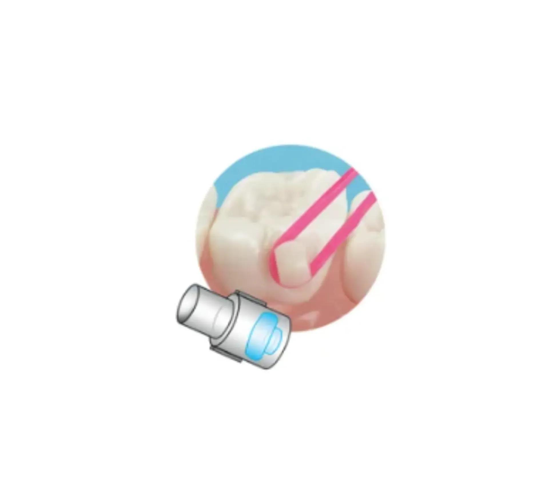 Stop Orthodontique Mini Mold Bouton (10)