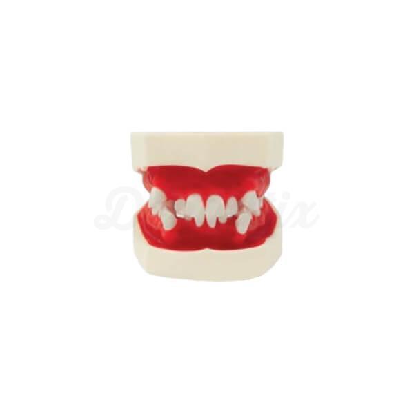 Typodont pour les pratiques orthodontiques