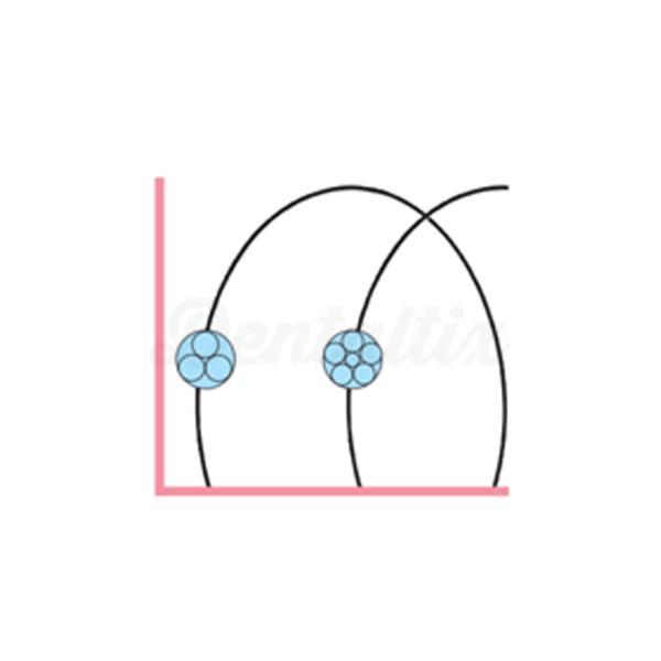Arc Twist Préformé (10 unités)