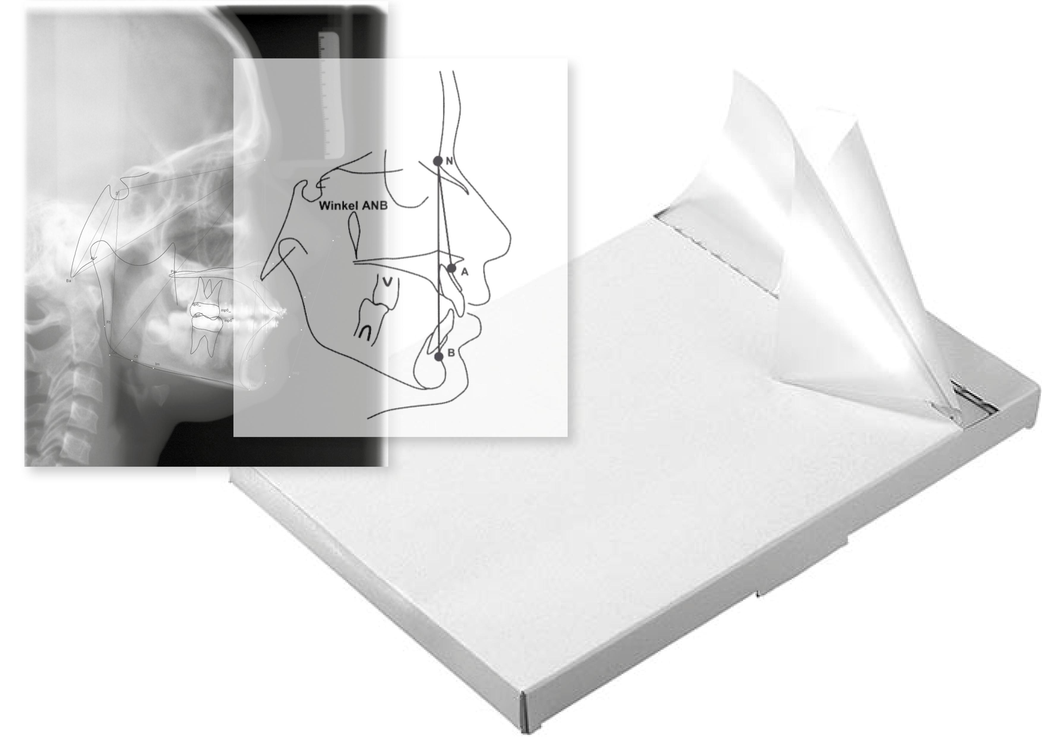 Tracing paper / cephalometric tracing pads
