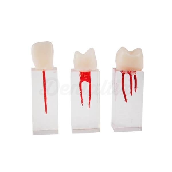 Set de dents Endo pour pratiques