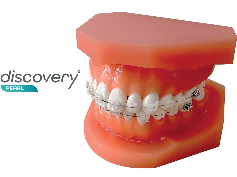 discovery™ pearl, modèle de démonstration en orthodontie