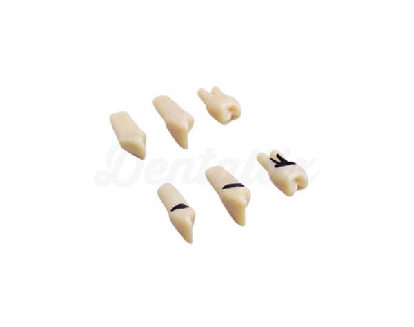 Set tanden voor model A-PZ (27 tanden)